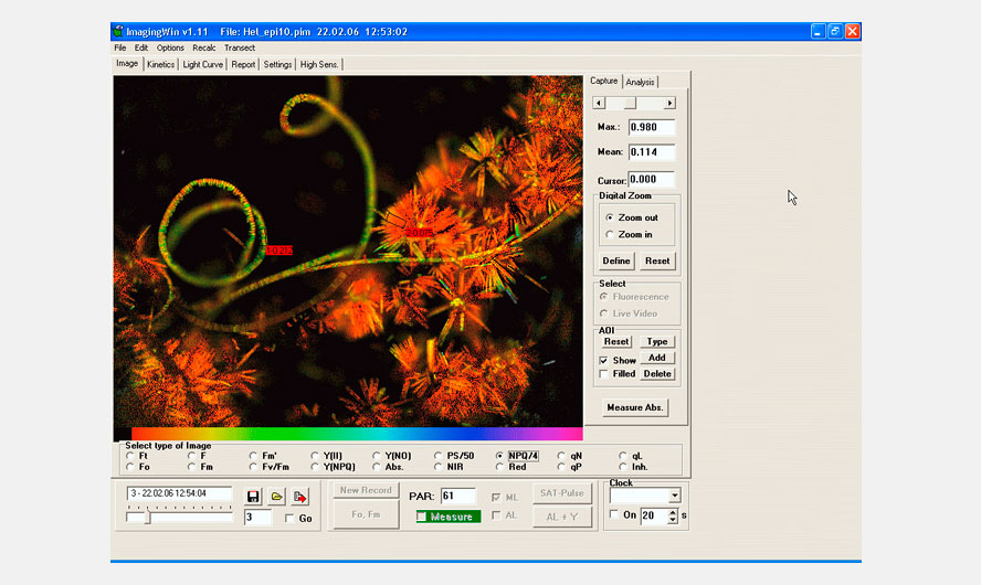 Filamentous algae sample with epiphytic population (Ft image).