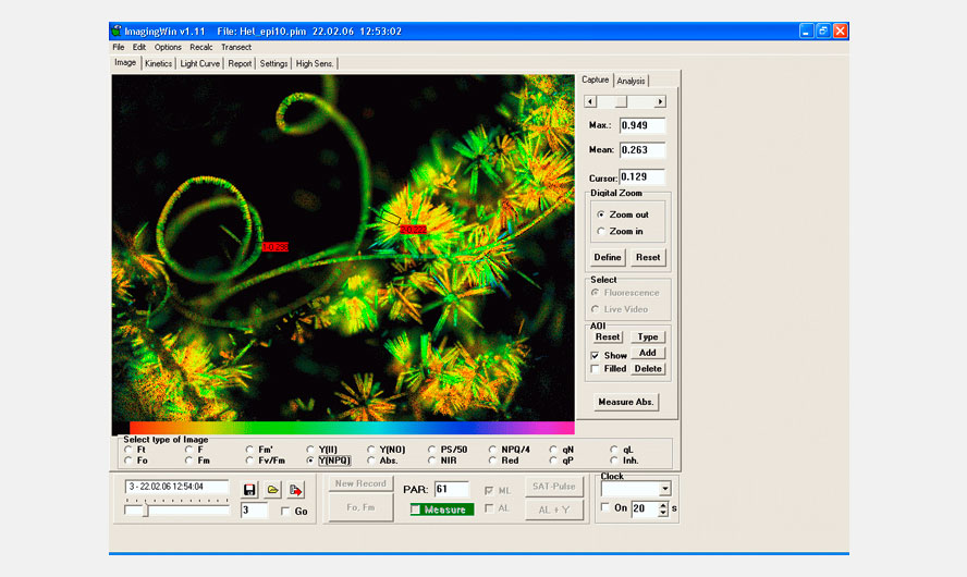 Filamentous algae sample with epiphytic population (Fm image).