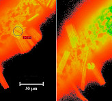 Closeup on epiphytes growing on filamentous algae sample (Ft image).