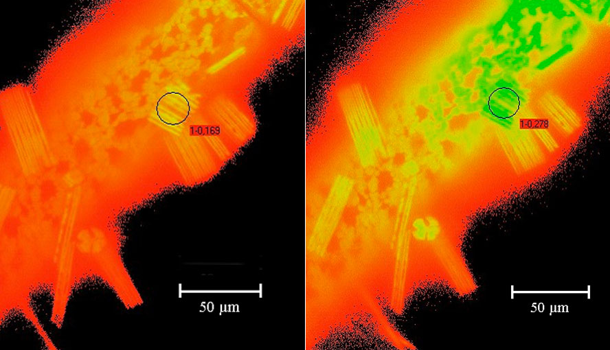 Closeup on epiphytes growing on filamentous algae sample (Ft image).