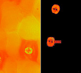 Epidermal strip with stomates (Ft image).