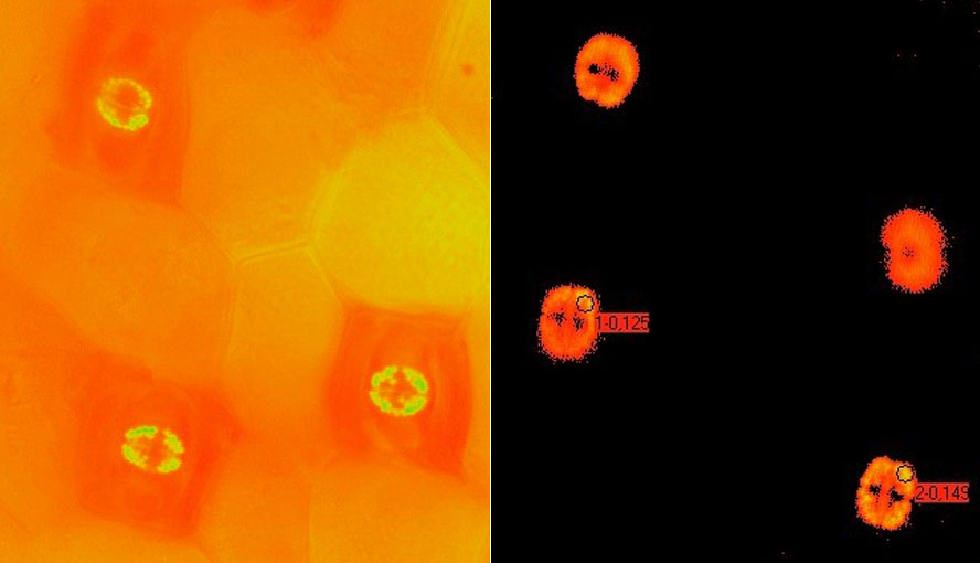 Epidermal strip with stomates (Ft image).